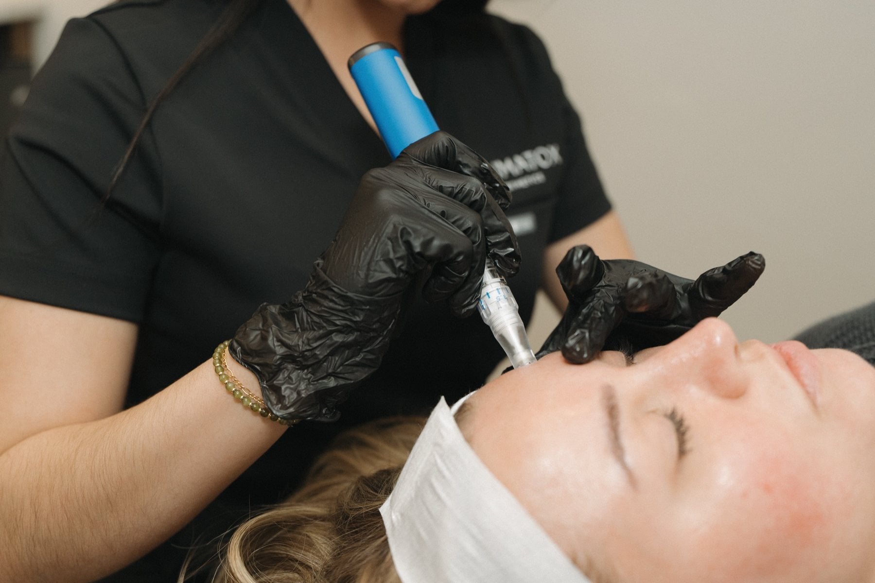 A laser skin treatment in progress at Illumatox Aesthetic Studio in Neenah
